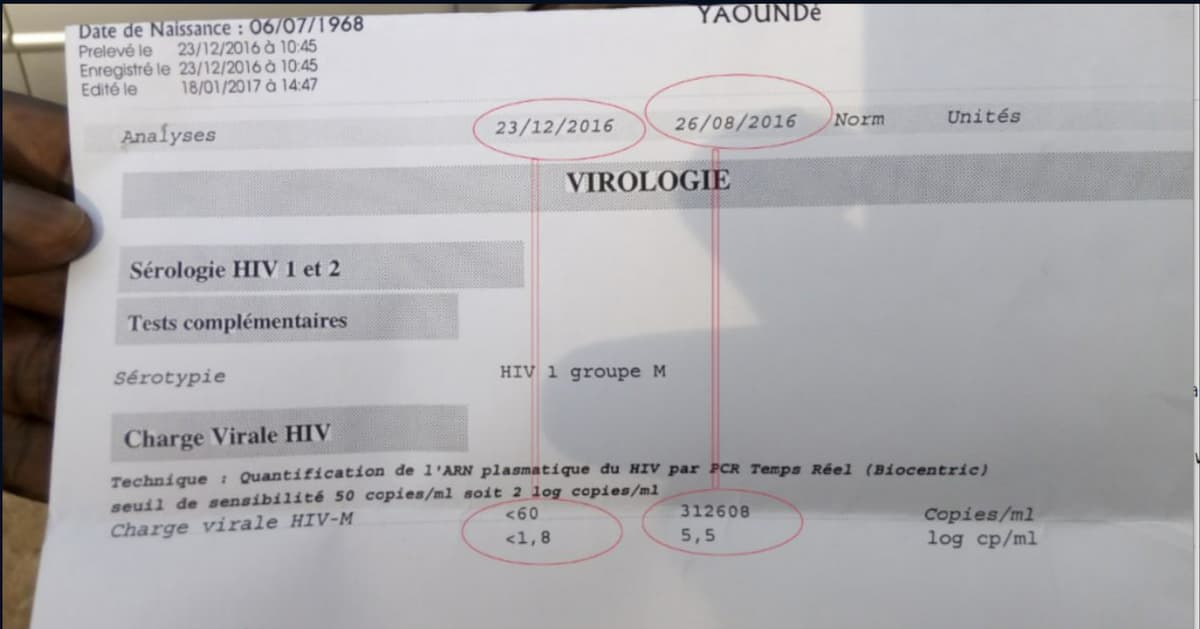 hiv-pcr-10
